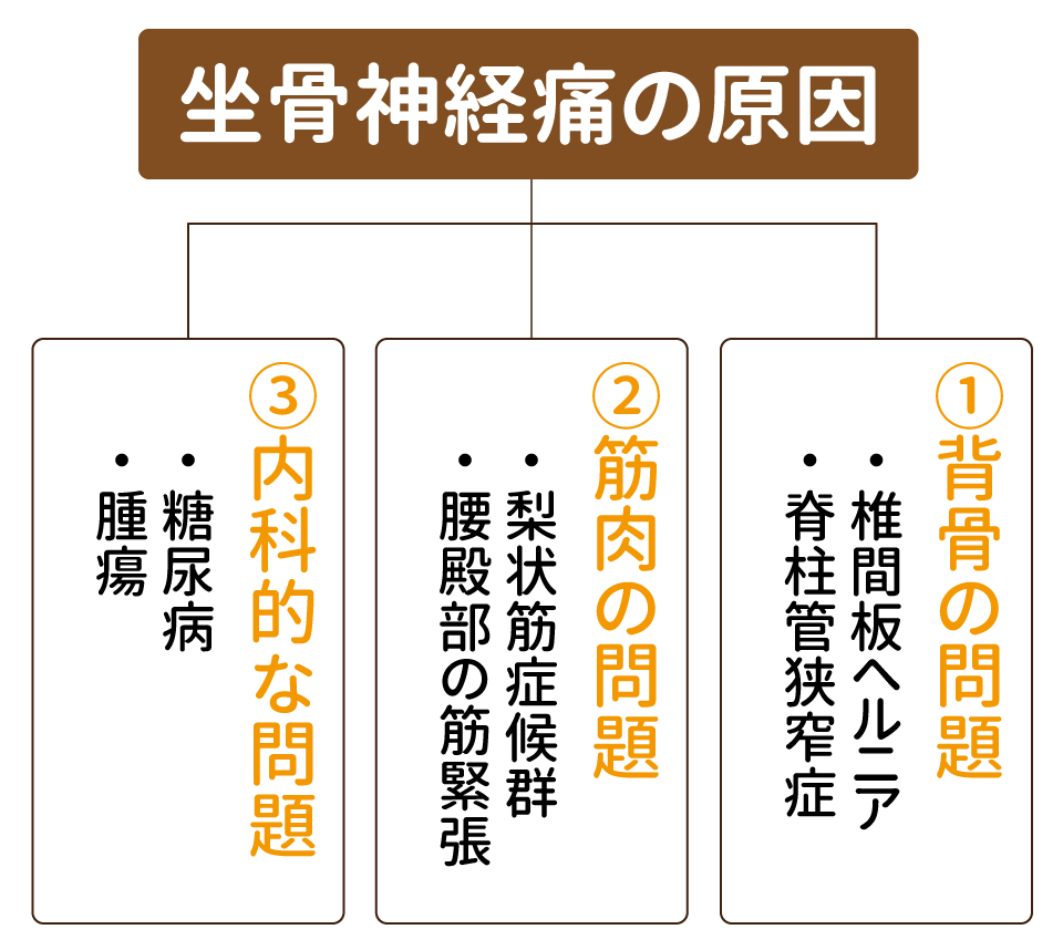 坐骨神経痛の原因