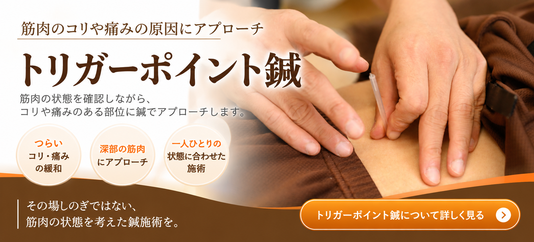 トリガーポイント鍼の詳しいご案内